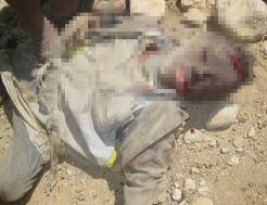 Yemen'den korkunç katliam kareleri 3